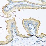 NOV Antibody in Immunohistochemistry (Paraffin) (IHC (P))