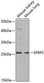 SFRP2 Antibody in Western Blot (WB)