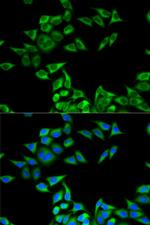 CHMP2B Antibody in Immunocytochemistry (ICC/IF)