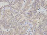 CHMP2B Antibody in Immunohistochemistry (Paraffin) (IHC (P))