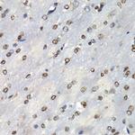 PSMB10 Antibody in Immunohistochemistry (Paraffin) (IHC (P))