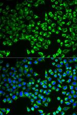 Citrate Synthase Antibody in Immunocytochemistry (ICC/IF)