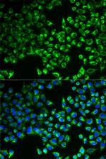 Citrate Synthase Antibody in Immunocytochemistry (ICC/IF)