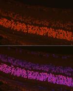 CRX Antibody in Immunocytochemistry (ICC/IF)