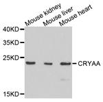 Alpha A Crystallin Antibody in Western Blot (WB)