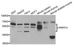 PRPF31 Antibody in Western Blot (WB)