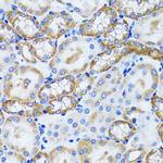 PEX5 Antibody in Immunohistochemistry (Paraffin) (IHC (P))