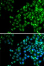 EPC1 Antibody in Immunocytochemistry (ICC/IF)