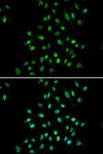 CGBP Antibody in Immunocytochemistry (ICC/IF)