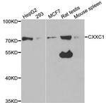 CGBP Antibody in Western Blot (WB)