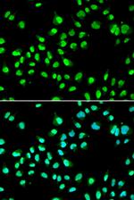 GTF2F2 Antibody in Immunocytochemistry (ICC/IF)