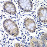 GTF2F2 Antibody in Immunohistochemistry (Paraffin) (IHC (P))