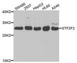 GTF2F2 Antibody in Western Blot (WB)