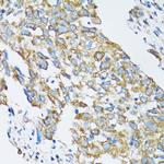 SLC25A13 Antibody in Immunohistochemistry (Paraffin) (IHC (P))