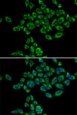 SRPK1 Antibody in Immunocytochemistry (ICC/IF)