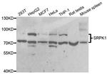 SRPK1 Antibody in Western Blot (WB)