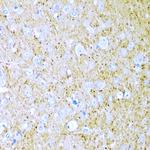 WNT2 Antibody in Immunohistochemistry (Paraffin) (IHC (P))