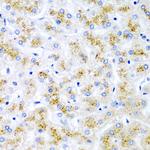 WNT2 Antibody in Immunohistochemistry (Paraffin) (IHC (P))