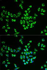 MRPL28 Antibody in Immunocytochemistry (ICC/IF)