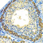 MRPL28 Antibody in Immunohistochemistry (Paraffin) (IHC (P))