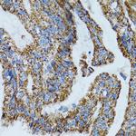 MRPL28 Antibody in Immunohistochemistry (Paraffin) (IHC (P))