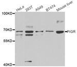 PIGR Antibody in Western Blot (WB)