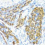 KMT2E Antibody in Immunohistochemistry (Paraffin) (IHC (P))