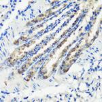 KMT2E Antibody in Immunohistochemistry (Paraffin) (IHC (P))