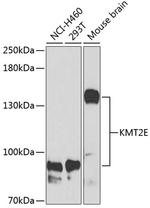 KMT2E Antibody in Western Blot (WB)