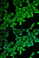 DAP Antibody in Immunocytochemistry (ICC/IF)