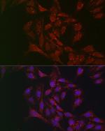 ATGL Antibody in Immunocytochemistry (ICC/IF)