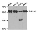 ATGL Antibody in Western Blot (WB)