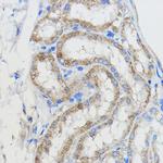 CYP51A1 Antibody in Immunohistochemistry (Paraffin) (IHC (P))