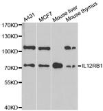 IL12RB1 Antibody in Western Blot (WB)