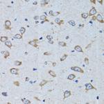 RARS Antibody in Immunohistochemistry (Paraffin) (IHC (P))