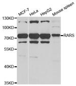 RARS Antibody in Western Blot (WB)