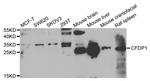 CFDP1 Antibody in Western Blot (WB)