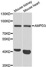 AMPD3 Antibody in Western Blot (WB)