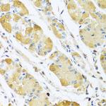 C4BPB Antibody in Immunohistochemistry (Paraffin) (IHC (P))