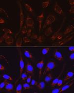 CAT1 Antibody in Immunocytochemistry (ICC/IF)