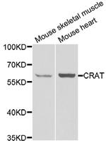 CAT1 Antibody in Western Blot (WB)