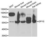 DPYS Antibody in Western Blot (WB)