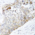 PPOX Antibody in Immunohistochemistry (Paraffin) (IHC (P))