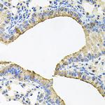 SKAP2 Antibody in Immunohistochemistry (Paraffin) (IHC (P))