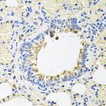 SKAP2 Antibody in Immunohistochemistry (Paraffin) (IHC (P))