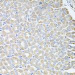 SKAP2 Antibody in Immunohistochemistry (Paraffin) (IHC (P))