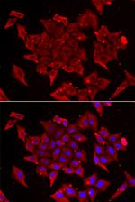 TIM17 Antibody in Immunocytochemistry (ICC/IF)