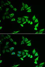 MYOZ2 Antibody in Immunocytochemistry (ICC/IF)