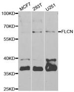 Folliculin Antibody in Western Blot (WB)