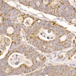 GluD2 Antibody in Immunohistochemistry (Paraffin) (IHC (P))